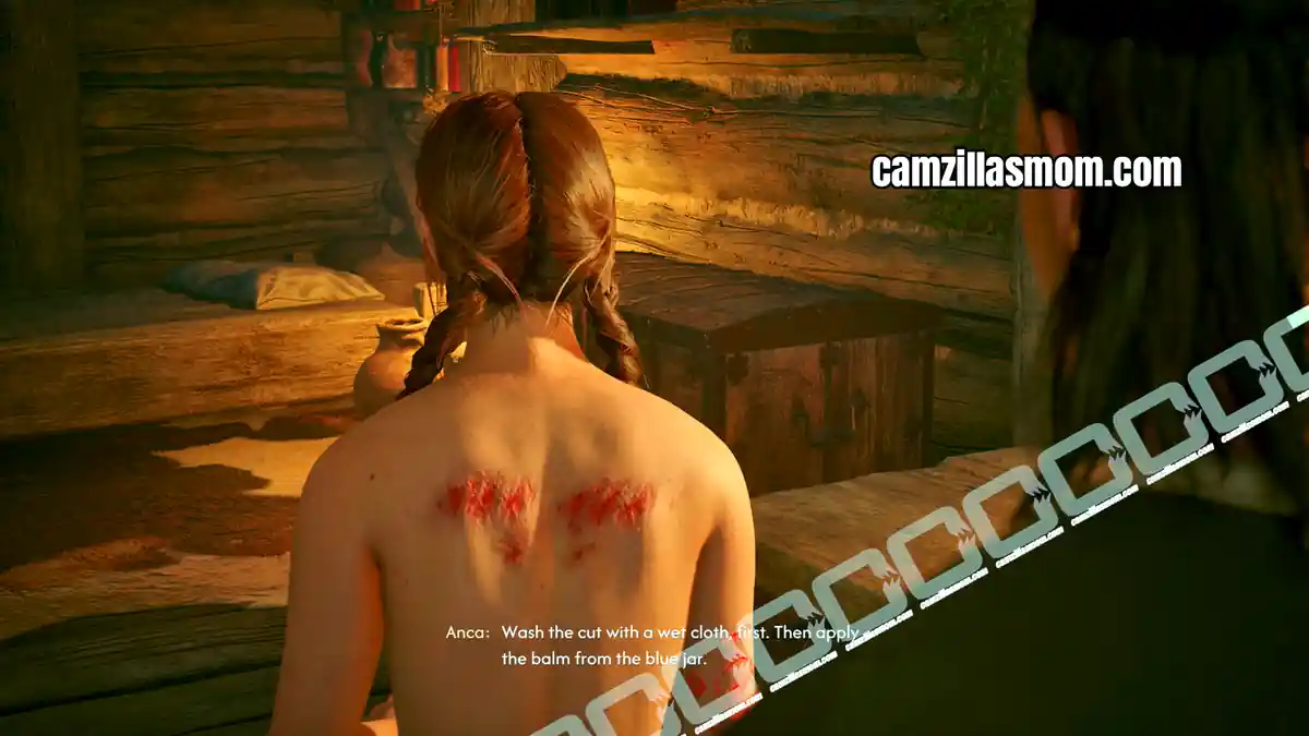 treat-ancas-wound-withering-away-the-blood-of-dawnwalker Coen treating Ancas injured back inside the house. › camzillasmom.com